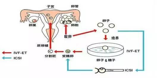 生育科技与社会伦理：捐卵经济价值及道德考量